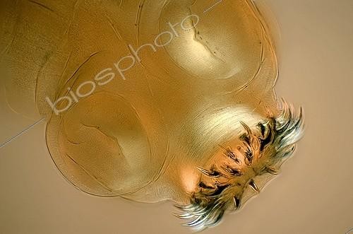 Biosphoto | 493102 | Details of the scolex of Taenia Cysticercus pisiformis | &copy; Christian Gautier / Biosphoto
