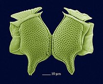 Biosphoto | 512046 | Dinophysis caudata | &copy; Pascal Goetgheluck / Biosphoto