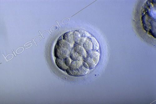 Biosphoto | 511512 | In vitro fertilization | &copy; Pascal Goetgheluck / Biosphoto