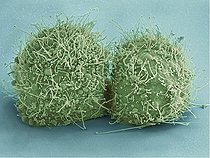 Biosphoto | 2473701 | Scanning electron micrograph of just-divided HeLa cells. Zeiss Merlin HR-SEM. | &copy; National Institutes of Health / Stocktrek Images / Biosphoto