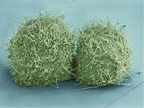 Biosphoto | 2473701 | Scanning electron micrograph of just-divided HeLa cells. Zeiss Merlin HR-SEM. | &copy; National Institutes of Health / Stocktrek Images / Biosphoto
