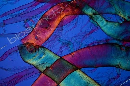 Biosphoto | 583930 | Tracheum of Scolopendra under microscope  ; Lighting in polarized light with blade compensatory gypsum, magnification x 50.  | &copy; Christian Gautier / Biosphoto